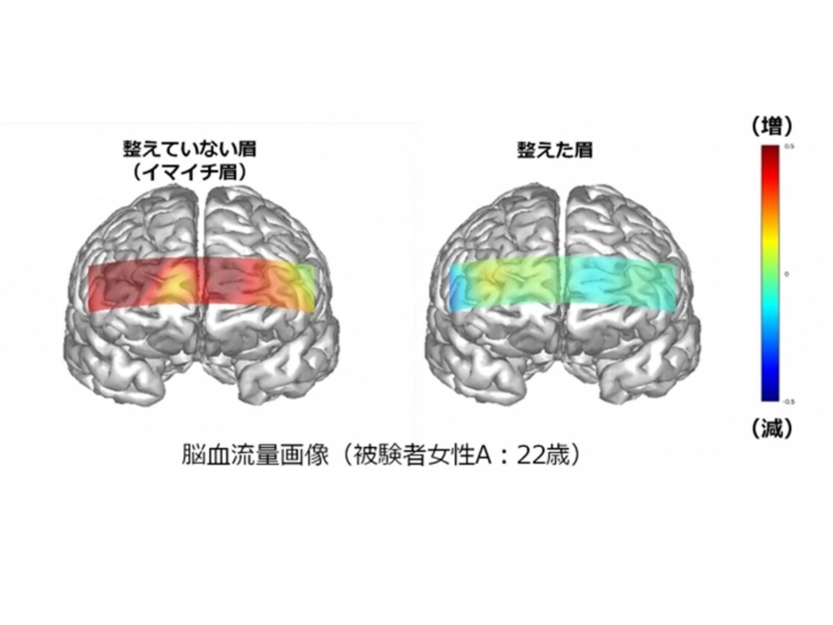 眉２