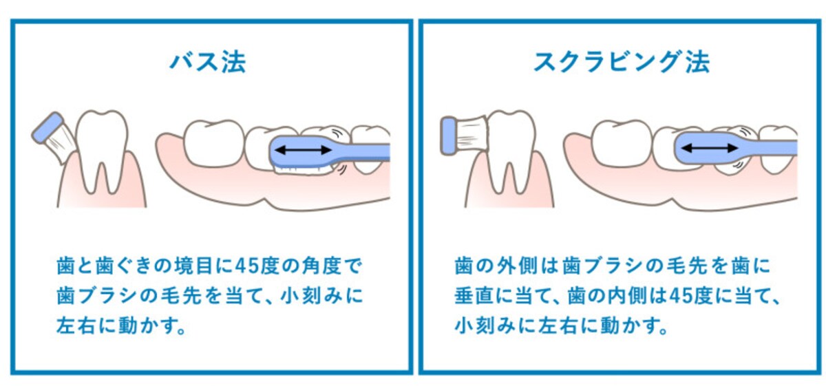 「バス法」「スクラビング法」を理解して、効率の良い歯周病予防を