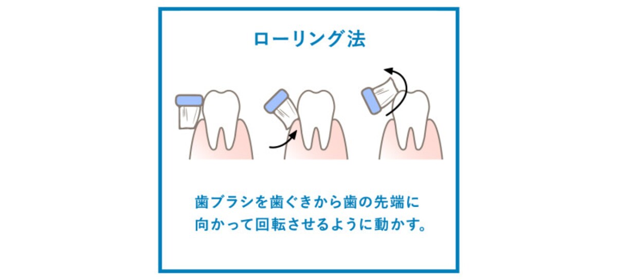「ローリング法」は歯の表面や着色汚れを落とすときに