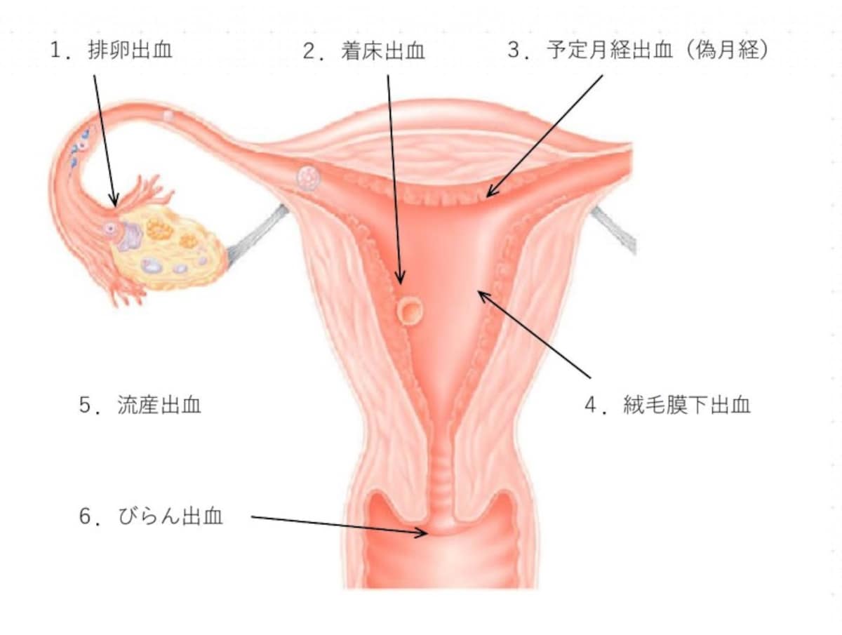 妊娠初期の出血には、着床出血や排卵出血、流産による出血など……いくつか原因が