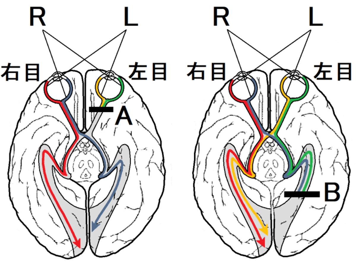 視覚伝導路,半交叉,視覚野