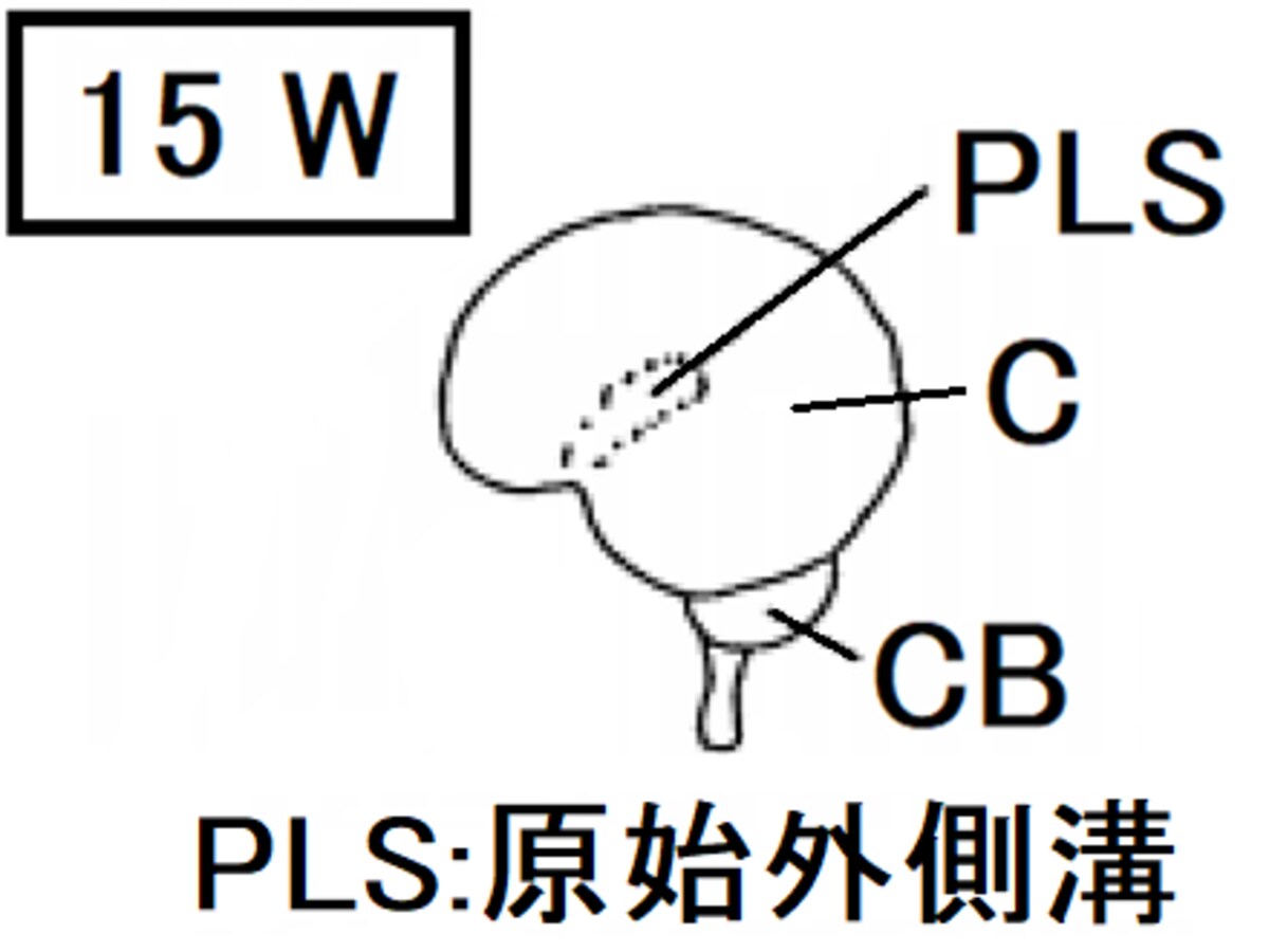 胎児,大脳,小脳,原始外側溝