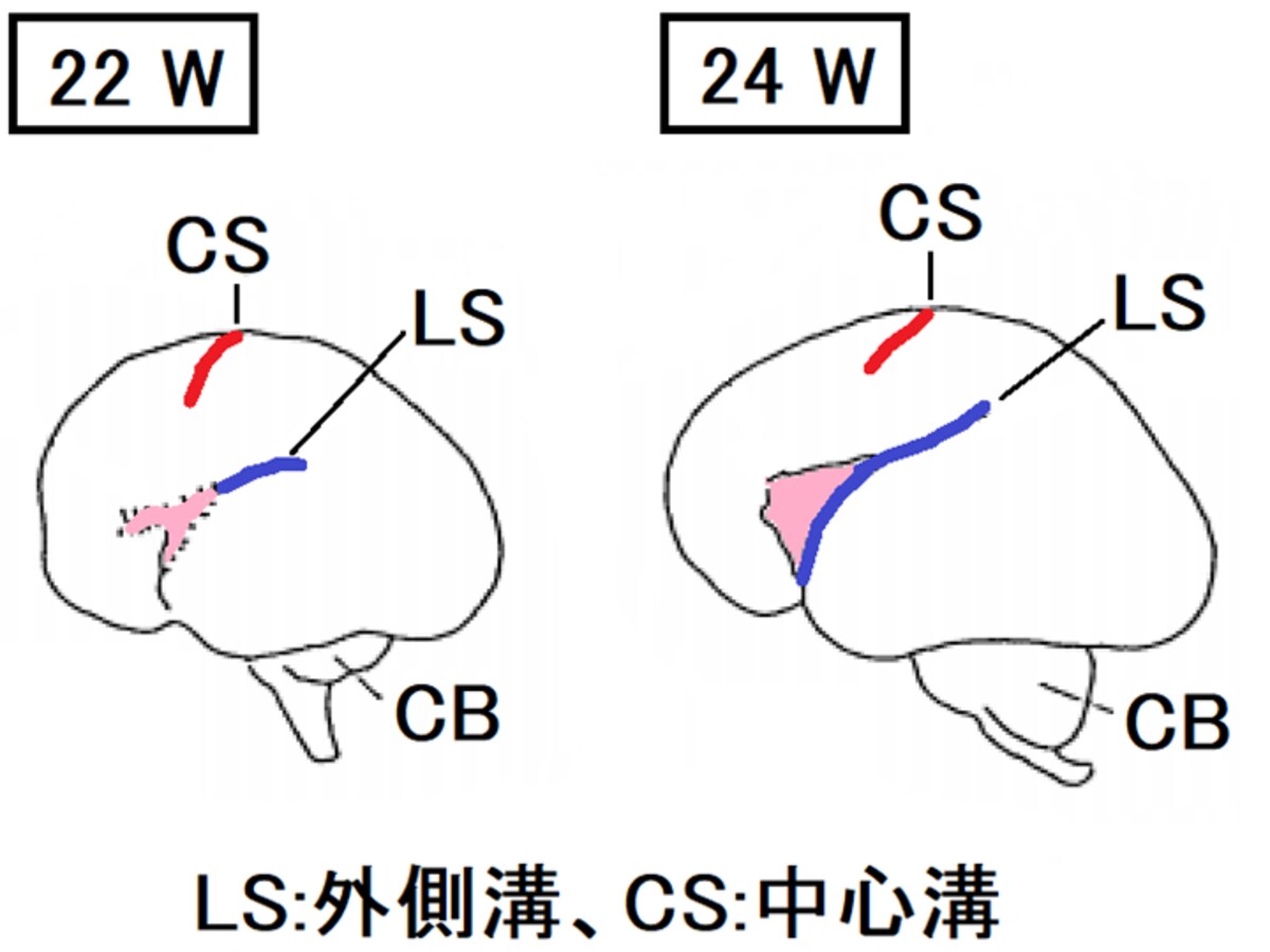 胎児,脳,外側溝,中心溝