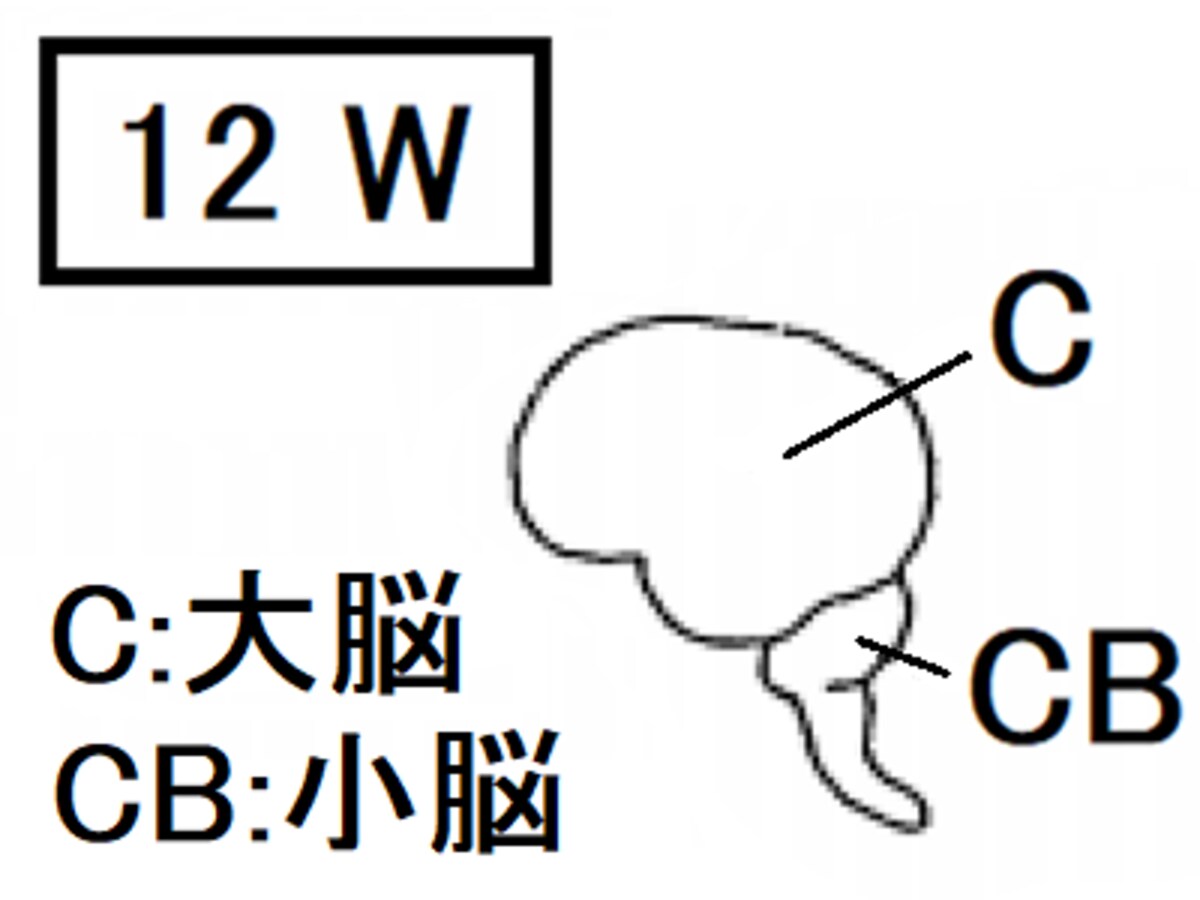 胎児,大脳皮質,小脳,