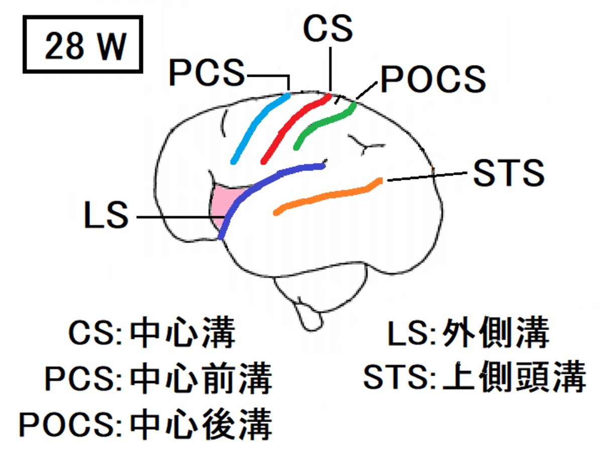 胎児脳,中心前溝,中心後溝,上側頭溝,
