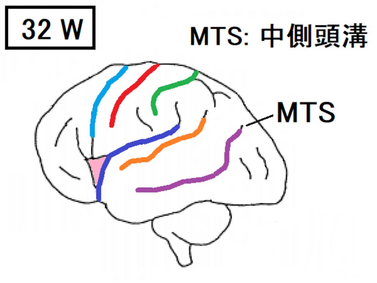 胎児,脳,中側頭溝