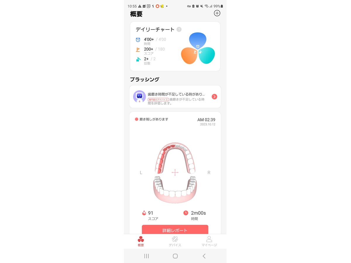 「Oclean Care+」で歯磨きデータの確認