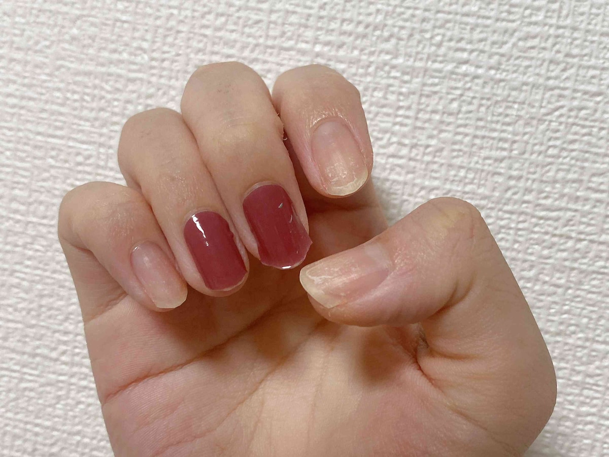 「貼るUVジェルネイルシール」は1日目の夜の時点で3本も剥がれてしまった