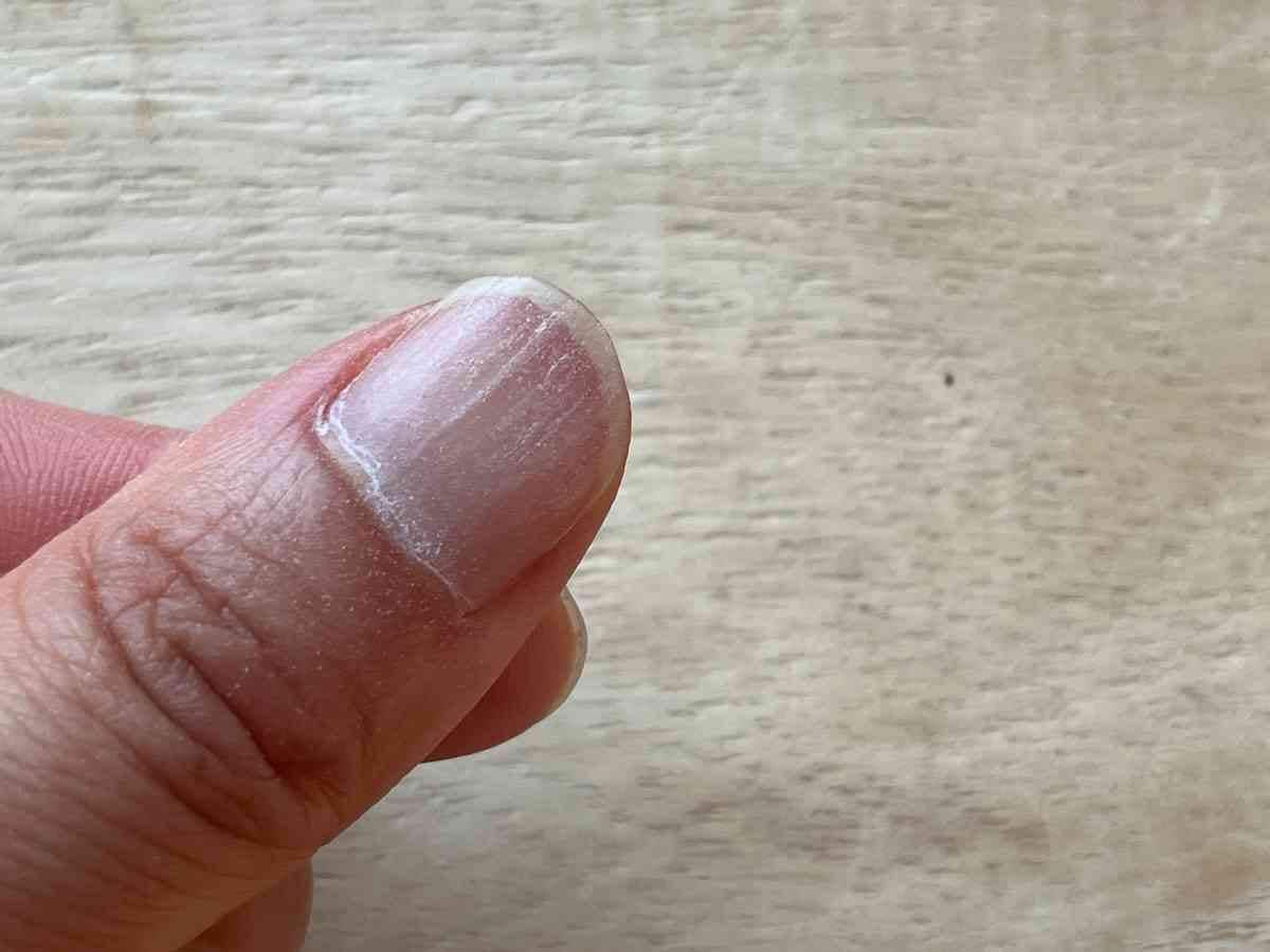 爪の表面が削れているので、白い粉が付着している