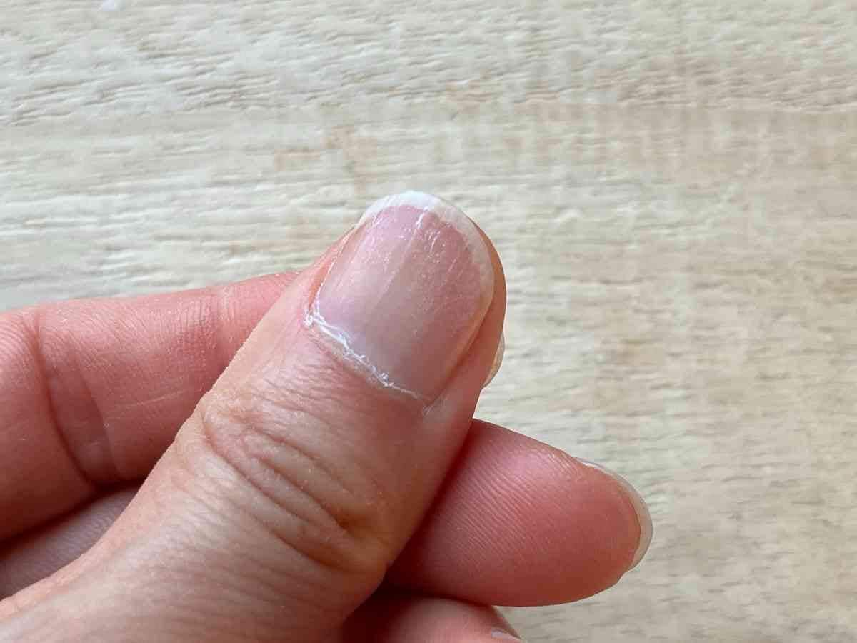 表面の凹凸がほぼ平らになっていた