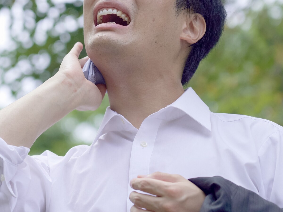 暑さに弱いボクを彼女は分かってくれない（画像：PIXTA）