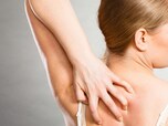 顔の湿疹は脂漏性皮膚炎 アトピー 考えられる原因と対処法 All About オールアバウト