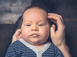 顔の湿疹は脂漏性皮膚炎 アトピー 考えられる原因と対処法 All About オールアバウト