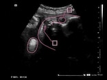 妊娠39週 エコー写真・胎児の大きさや体重