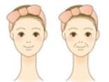 見た目年齢が大きく変わる「ほうれい線」の原因