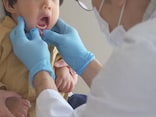 溶連菌感染症とは？ 発熱・発疹・喉の痛みなどの症状、治療のポイント…10日間の服薬が重要な理由