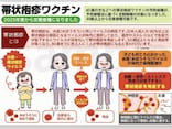 2025年4月定期接種化！ 帯状疱疹ワクチンの必須知識：種類・費用・後遺症リスクを徹底解説