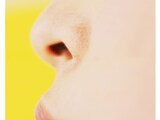アレルギー性鼻炎、花粉症からも…副鼻腔炎の原因・治療法