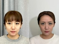 「凄い変化」高橋みなみ、小顔になったビフォーアフター写真に大反響！ 「素晴らしい技術」「えぐい」