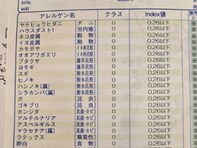 「なんで君だけ限界突破なん？」有名俳優、アレルギー検査の結果に驚きの声！ 「すごい」「笑いました」
