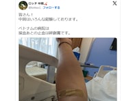 ロケで骨折のロッチ中岡、ベトナムの病院から近影公開「むちゃしないで下さい」「無理するなよ！」