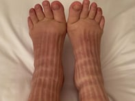 「赤ちゃんの足だと思いました！」双子出産の中川翔子、“むくみとのたたかい”を公開。「伊達巻みたい」