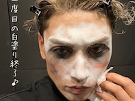 「凄いことになってる」樽美酒研二、“ちと動揺”衝撃ショットに心配の声「ひえええ　早く病院行って」