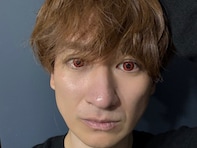 「ちょっと怖い」人気アイドル、報告投稿に反響！ 「吸血鬼みたい」「びっくりして横転」の声