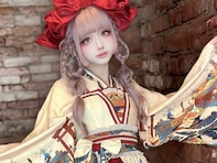 「絶対に真似しないで欲しい」女装タレント、手の血管除去手術を公表も批判殺到。謝罪「深くお詫びいたします」