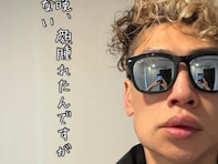 「これもアレルギーなんだろうか､､」樽美酒研二、顔の腫れに心配の声「すごく腫れてる」「大丈夫？」