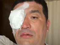 「痛々しいです」人気芸人、手術成功を報告。「大変でしたね」「白内障になっちゃうんだ、怖…」
