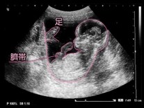 妊娠14週目エコー写真 胎児の大きさ お腹の張りは大丈夫 妊娠初期 All About
