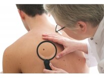 症例画像 皮膚がん 皮膚悪性腫瘍の症状 治療法 皮膚 爪 髪の病気 All About