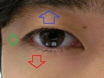 目の整形手術でできること 二重整形 All About