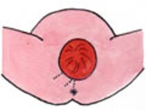 会陰切開ってどういうもの 出産の基礎知識 All About