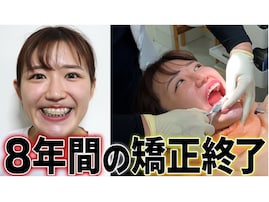 「有村架純になった」30万人超えYouTuber、歯列矯正のビフォーアフターに大反響！ 「やっぱり可愛い」