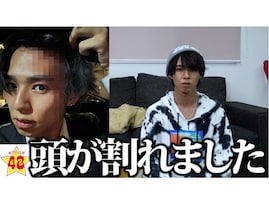 「頭が割れた」フォーエイト48・タロー社長、突然のけが報告にメンバー騒然「サムネ大丈夫か!?」の声