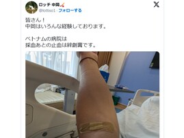 ロケで骨折のロッチ中岡、ベトナムの病院から近影公開「むちゃしないで下さい」「無理するなよ！」