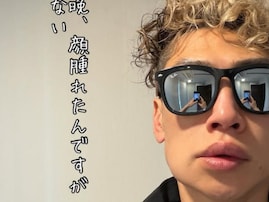 「これもアレルギーなんだろうか､､」樽美酒研二、顔の腫れに心配の声「すごく腫れてる」「大丈夫？」