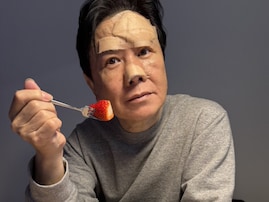 「でっかい傷跡が残ってます」ベテラン声優、けがからの回復ショットを公開。「正直ホッとしました」