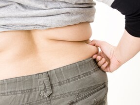 下半身よりもウエストまわりが大きくなる体型から「リンゴ型肥満」とも呼ばれることも