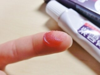 紫雲膏 しうんこう 漢方 漢方薬 all about