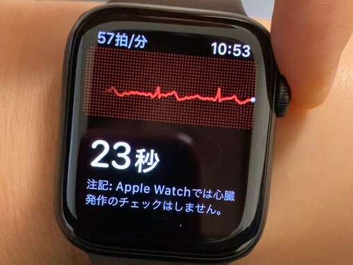 Apple Watchの心電図アプリを早速使ってみた！ 最新OS提供開始