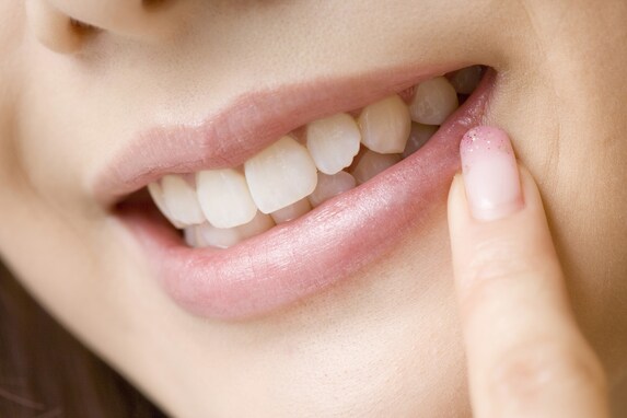 約1200人に聞いた『歯のコンプレックス』！ 1位は「虫歯」や「歯並び」ではなく……？