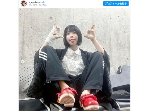 「コスプレのようで草」あの、骨折後の最新ショット公開！ 「骨折れててもさいこうにかわいい」