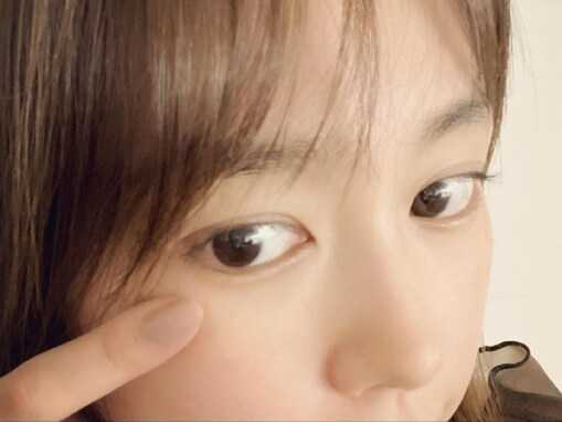 桐谷美玲、“ICL手術”で視力0.06から1.5に回復！ 「裸眼最高ですよね」「視界が良好になって嬉しいです」