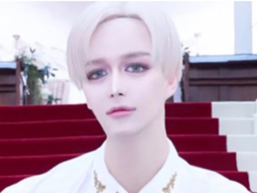 Matt、「全治2〜3ヶ月」の大けが報告。災難続きの現状に「お祓いに行った方がいい気が」心配の声あふれる