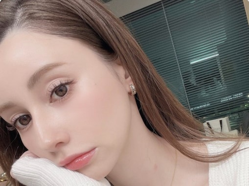 「キスマークにみえる」ダレノガレ明美、“首のやけど”が話題に。「美白肌に痛々しい」と心配の声も