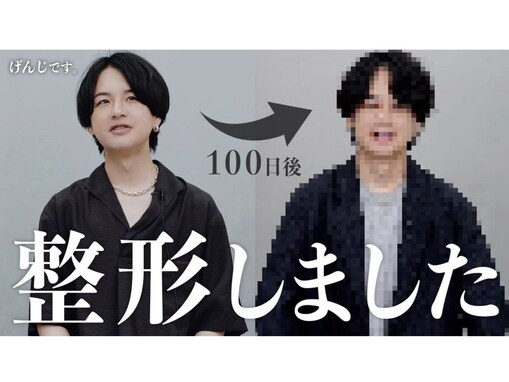 登録者80万人超えファッション系YouTuber、総額250万円の整形を告白。「大成功ですね！」「めっちゃカッコよくなってて良いな～」