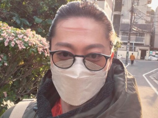 はんにゃ.金田哲、おでこが気になる自撮りショットに「おでこどうしたの」「話が入ってきません」の声